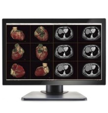 Double Black Imaging Image Systems Gemini 6MP Large Format Display